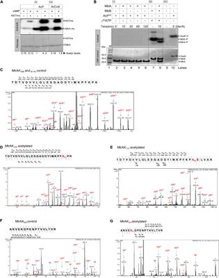 Acetylation of Response Regulator Protein MtrA in M. tuberculosis Regulates Its Repressor Activity